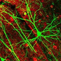 Neuronas