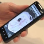 Aplicación móvil para diagnosticar derrames cerebrales