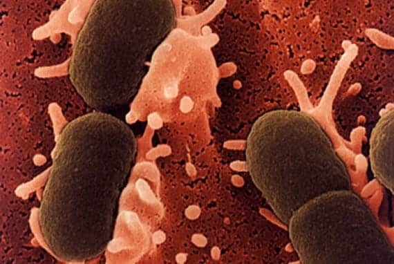 Bacterias