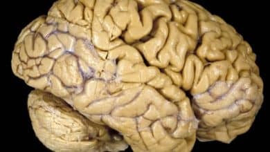Los antipsicóticos pueden reducir el tamaño del cerebro