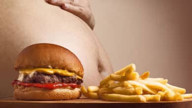 Relación entre el tamaño del cerebro y la obesidad