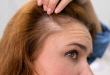 ¿Cuáles son los tratamientos capilares más eficaces para fortalecer el cabello y evitar su caída?