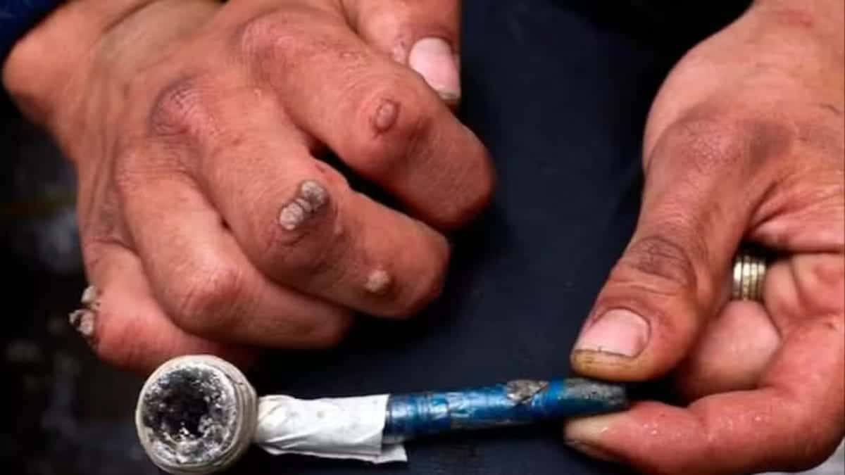 La muerte y el consumo de basuco o bazuco están relacionados